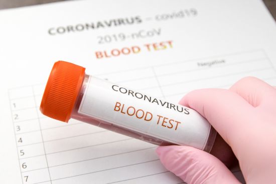 Czy nauczyciel musi zrobić test na koronawirus?
